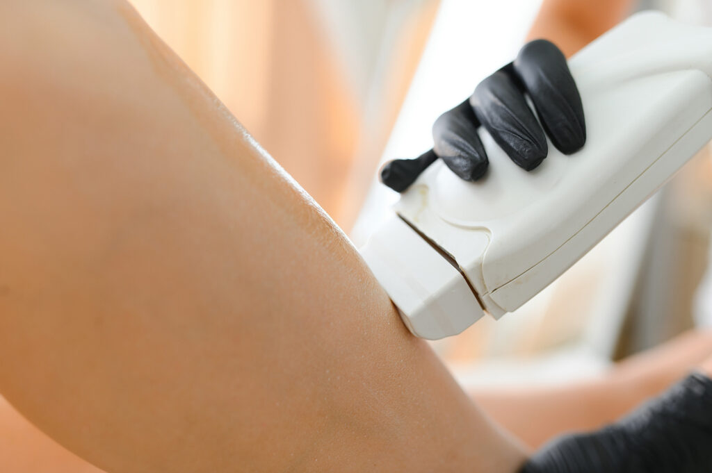 Depilación Eléctrica en Ana Hata Belleza en Sopela