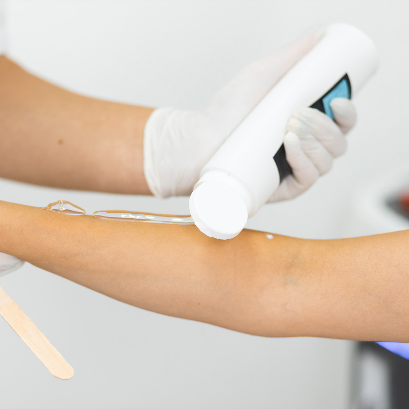 Depilación Eléctrica en Ana Hata Belleza en Sopela