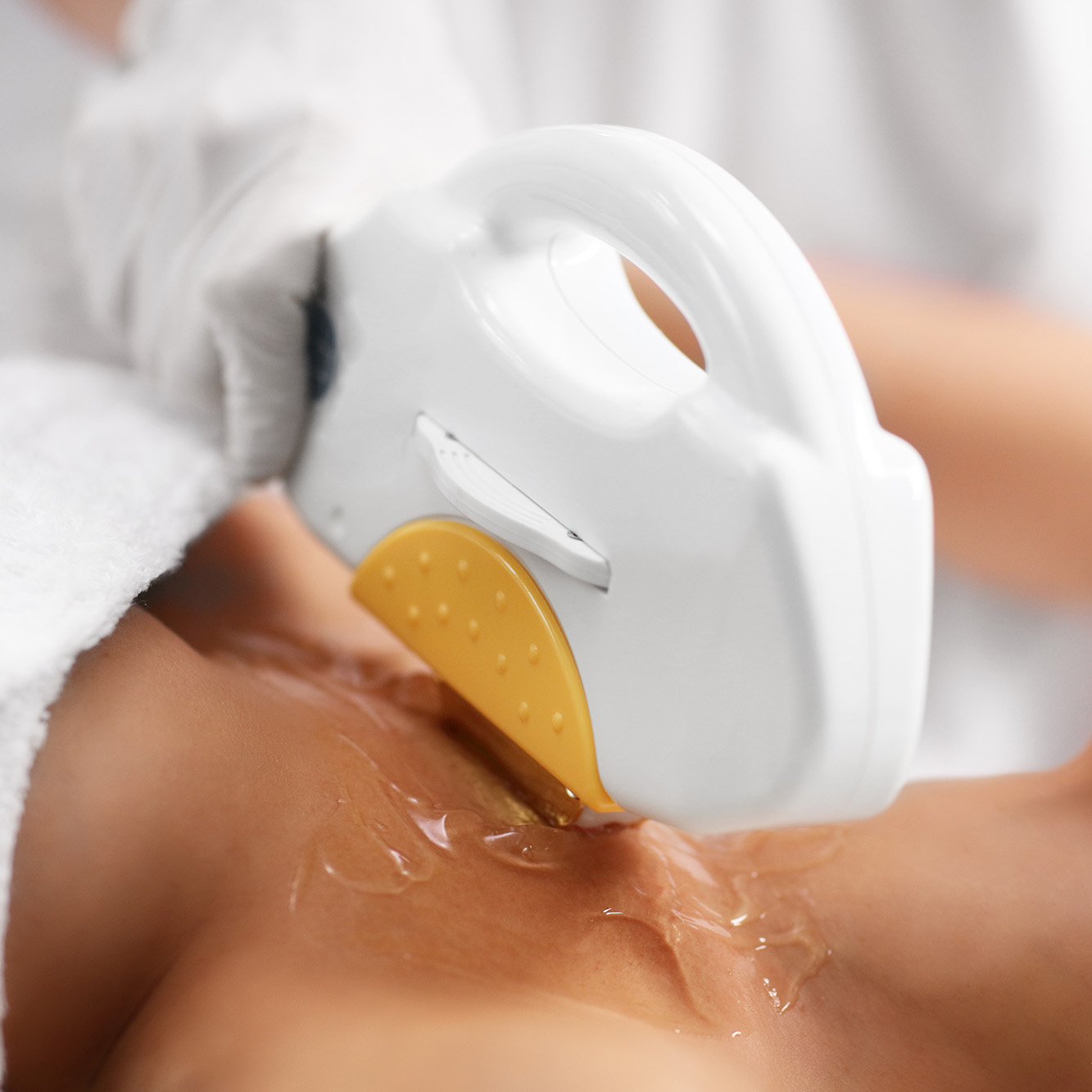 Depilación Laser en Ana Hata Belleza