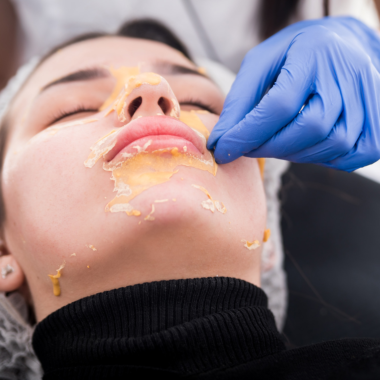 Peeling enzimático en Ana Hata Belleza