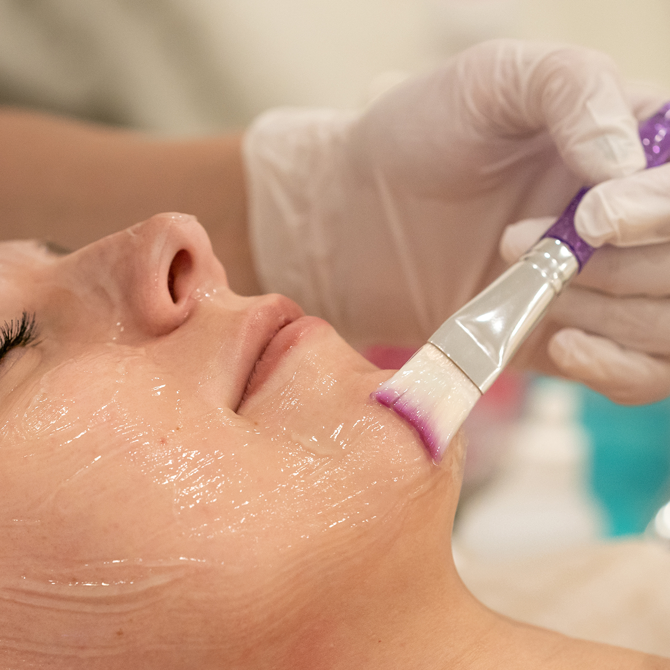 Tratamientos faciales Tratamiento antiacné Ana Hata Belleza