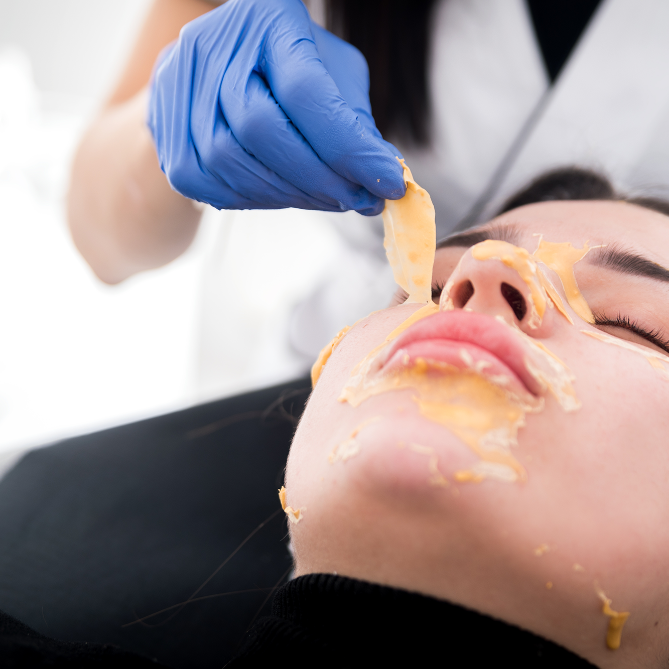 Tratamientos faciales Tratamiento antiacné Ana Hata Belleza